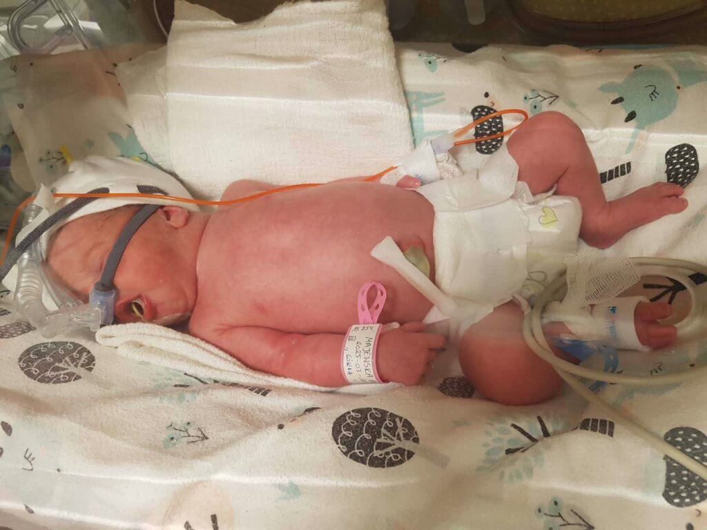 foto: Szpital Uniwersytecki w Zielonej Górze