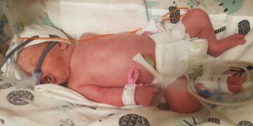 foto: Szpital Uniwersytecki w Zielonej Górze